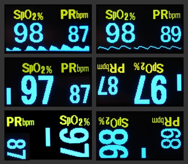 Oximeter Werte - Pin On Pulsoximeter : Die batterien bitte entnehmen, wenn das oximeter längere zeit nicht benutzt wird.